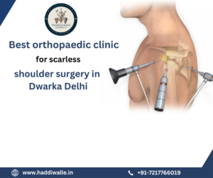 Best orthopaedic clinic for scarless Shoulder Surgery in Dwarka Delhi